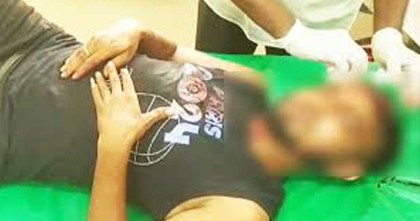 আওয়ামী লীগ নেতার হামলায় আইসিইউতে সেচ্ছাসেবক দল নেতা