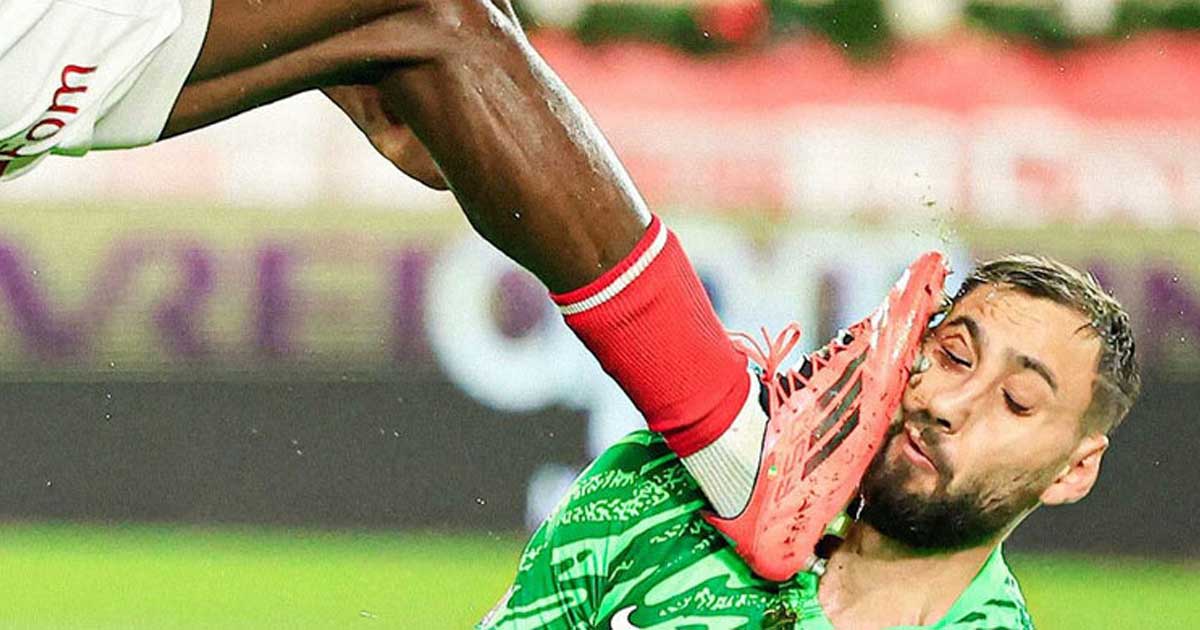 বুটের আঘাতে পিএসজি গোলকিপারের মুখে মারাত্মক জখম
