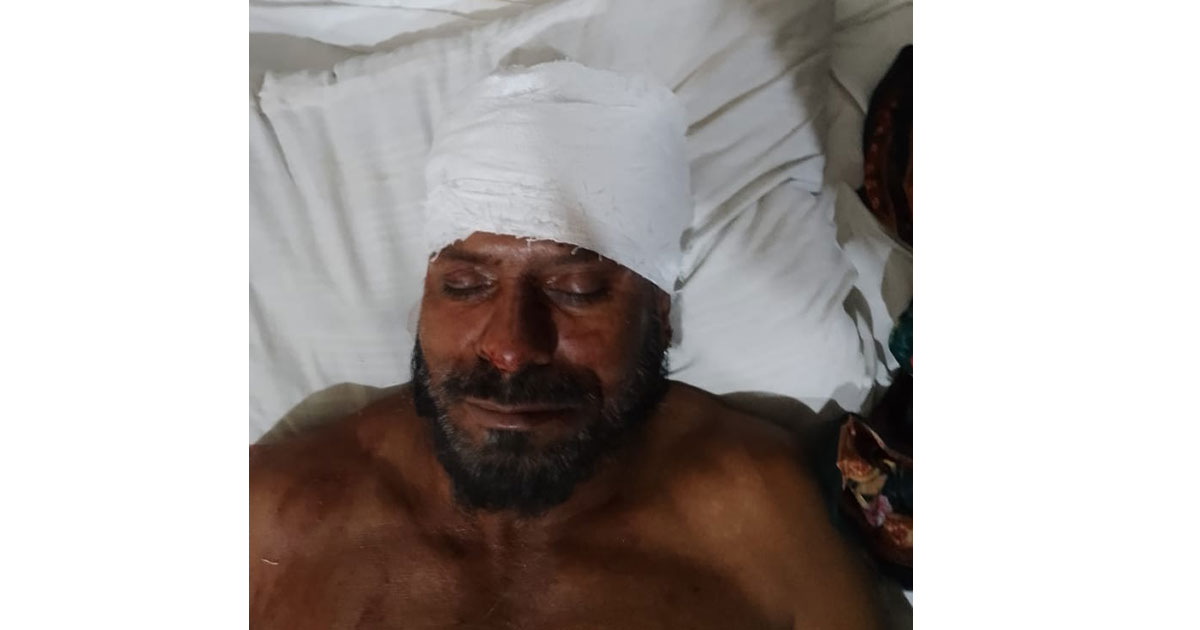 ভোলায় ছাত্রদলের হামলার আহত বিএনপি ও যুবদল নেতা