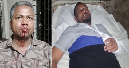 বরিশালে বিএনপি নেতার কান্ড : দলের দুই নেতাকে হাতুরি পেটা