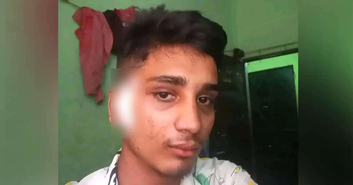 মাথায় গুলি নিয়েই মারা গেলেন জুলাই আন্দোলনে আহত হৃদয়