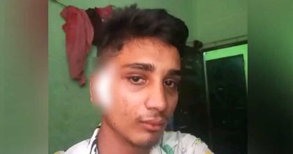 মাথায় গুলি নিয়েই মারা গেলেন জুলাই আন্দোলনে আহত হৃদয়