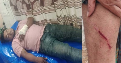 নোয়াখালীতে ফেসবুক স্ট্যাটাস নিয়ে ছাত্রদলের দুগ্রুপে সংঘর্ষ, আহত-৯