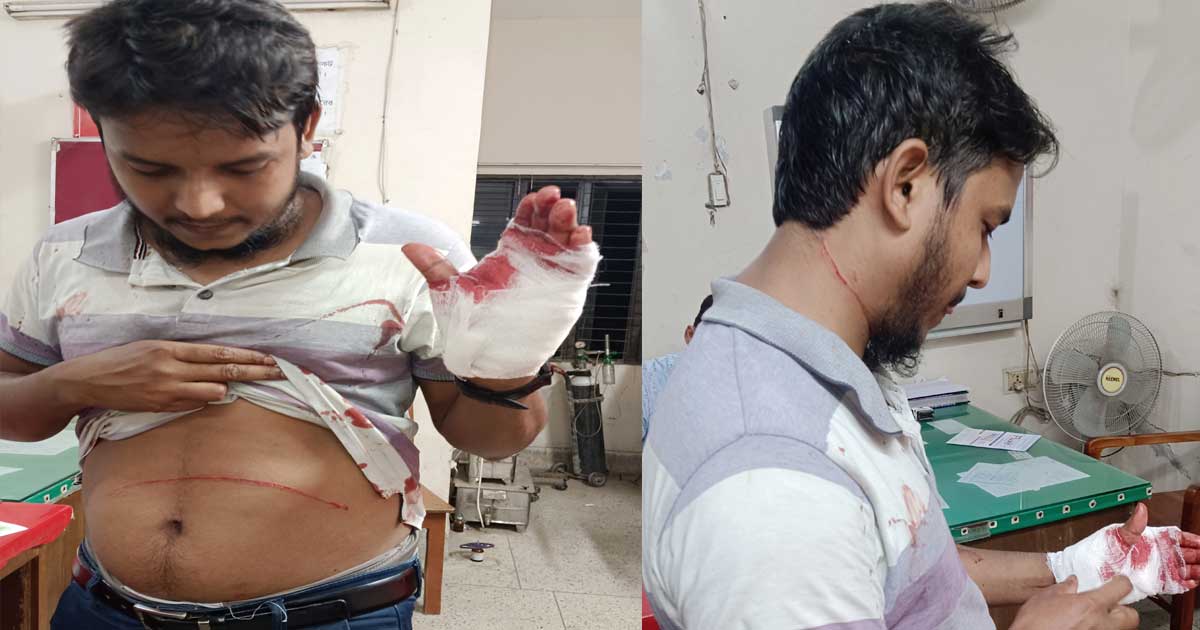 চাঁপাইনবাবগঞ্জে মৃত ব্যক্তিকে নিয়ে বাজে মন্তব্যের প্রতিবাদ করায় কুপিয়ে যখম
