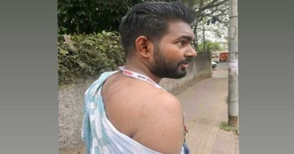 শতাধিক আহত হলেও নজরে শুধুই বোতল কাণ্ড