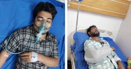 আন্দোলনে আহত হয়ে হাসপাতালে জবির দুই সাংবাদিক