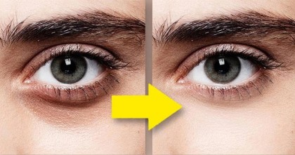 চোখের নিচের কালো দাগ দূর করতে কফির আইপ্যাচ