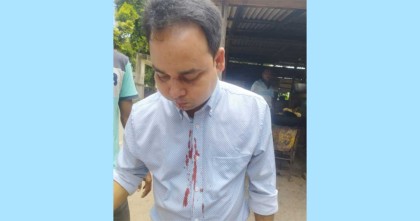 কুড়িগ্রামে ডিউটিতে এসে হামলার শিকার ফার্মাসিস্ট