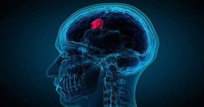 দূষণে বাড়ছে ব্রেইন টিউমারের ঝুঁকি, বলছে গবেষণা