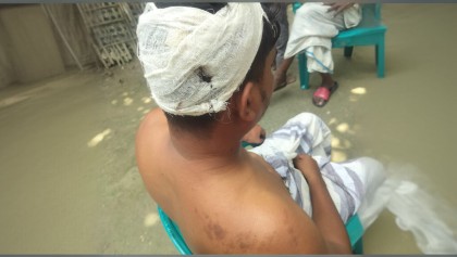 জাপানি প্রকল্পে চুরির প্রতিবাদে নিরাপত্তাকর্মীকে কুপিয়ে জখম