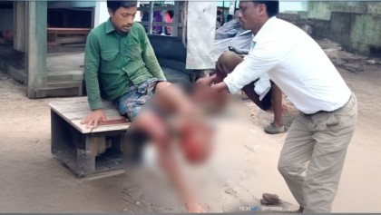 নাইক্ষ্যংছড়ি সীমান্তে মাইন বিস্ফোরণে এক যুবকের পা বিচ্ছিন্ন