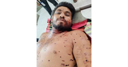 পরিচয়পত্র হাতে থেকেও বাঁচলেন না সাংবাদিক মেহেদী: পুলিশের গুলিতে ঝাঁঝরা দেহ