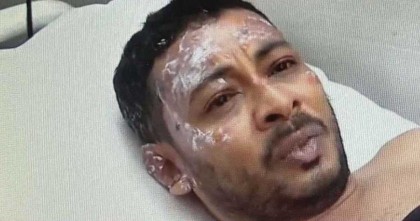 বিমান বিধ্বস্ত: আগুন থেকে বেঁচে ফেরা এক শিক্ষকের ভয়াবহ বর্ণনা