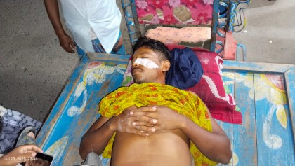 রাতে ট্রেন থেকে ছোড়া ঢিলে আহত যুবক, রংপুরে রেফার