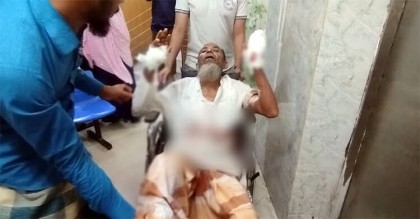 বাড়ি দখল করতে বাবাকে কুপিয়ে হাত-পা ভেঙে দিলো ছেলে