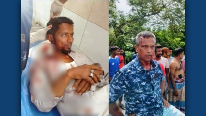 পুকুরের মাছ ধরাকে কেন্দ্র করে সংঘর্ষে নারীসহ আহত ৯