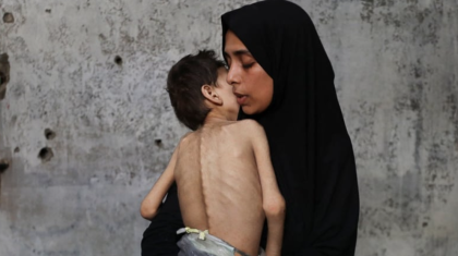 আমরা ধীরে ধীরে মারা যাচ্ছি, গাজায় দুর্ভিক্ষ ও সহিংসতায় নেমে এসেছে মানবিক বিপর্যয়