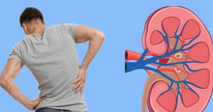 পিঠে-কোমরে ব্যথাও হতে পারে কিডনি রোগের লক্ষণ