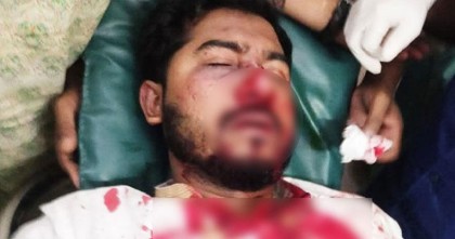জাপা কার্যালয়ের সামনে সংঘর্ষ; মারাত্মক আহত নুরুল হক নুর