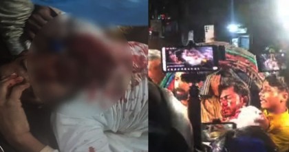 আহত নুরুল হক নুর ঢাকা মেডিকেলে