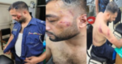 বিজয়নগরে ওয়ারেন্টের আসামী ছিনিয়ে নিতে পুলিশের উপর হামলা, ছয় পুলিশ আহত