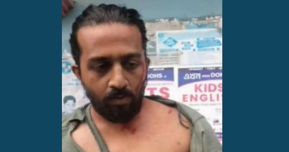 গণ বিশ্ববিদ্যালয়ের শিক্ষার্থীর ওপর সহপাঠীর হামলা