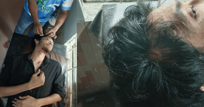 আবারও বহিরাগতদের হামলার শিকার নারীসহ বাকৃবির দুই শিক্ষার্থী