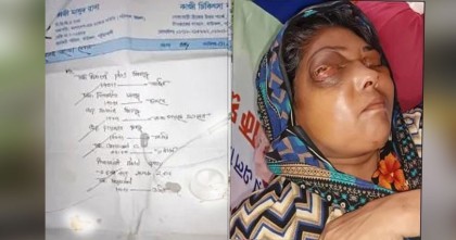 গ্রাম ডাক্তারের অপচিকিৎসায় দুই চোখ হারিয়ে মৃত্যু পথযাত্রী এক নারী