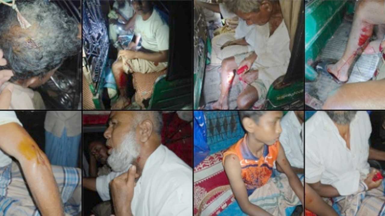 চট্টগ্রামে পুনরায় সংঘর্ষ, গুলিবিদ্ধসহ আহত ১৫