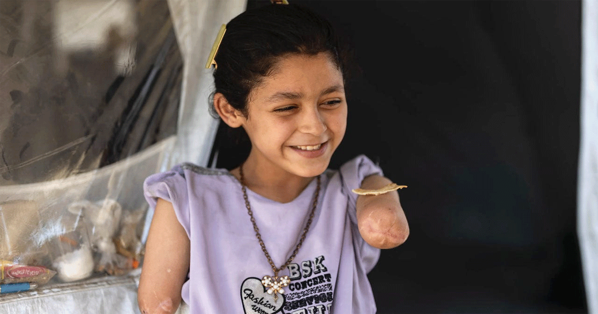 বিশ্বে গাজার শিশুরাই সবচেয়ে বেশি অঙ্গহানির শিকার