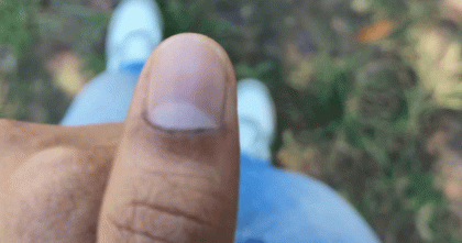 চাকসু নির্বাচন: মুছে যাচ্ছে কালি; অভিযোগ দেবে ছাত্রদল  