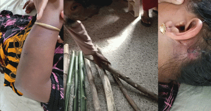 দশমিনায় কবরস্থানের জায়গা নিয়ে দুই পক্ষের সংঘর্ষে অন্তঃসত্ত্বা নারীসহ আহত সাত