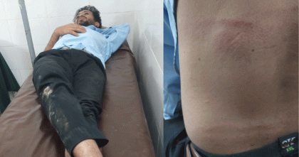 মাদকে বাধা দেওয়ায় বাঁশখালীতে যুবকের ওপর হামলা, থানায় লিখিত অভিযোগ দায়ের