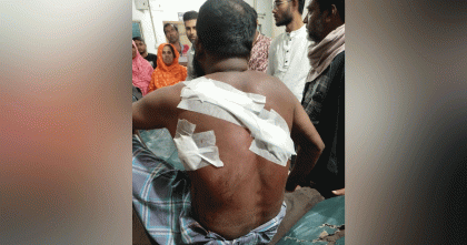 বগুড়ায় স্বেচ্ছাসেবক লীগের সন্ত্রাসী বাহিনী ছুরিকাঘাতে আহত জামায়াত নেতা