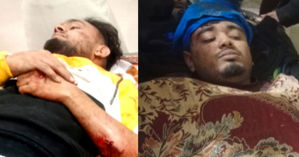 বগুড়ায় জমি চাষে চাঁদা দাবি; গণপিটুনিতে আহত দুই যুবক