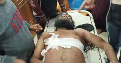 ব্রাহ্মণবাড়িয়ায় আবারো গুলিবর্ষণ, যুবক গুলিবিদ্ধ