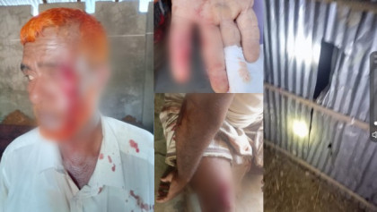 বাঁশখালীতে পূর্ব বিরোধের জেরে সংঘবদ্ধ হামলা, নারীসহ আহত ৯