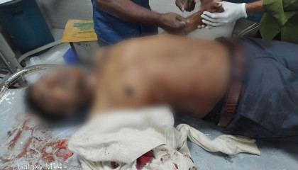 বগুড়ায় ভোটের দিন সম্পাদক প্রার্থীকে তুলে নিয়ে গিয়ে হাত-পা ভেঙে দিয়েছে যুবদল নেতা