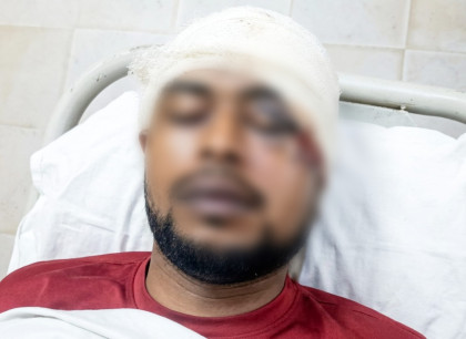 ব্রাহ্মণবাড়িয়ায় সড়ক দুর্ঘটনায় অজ্ঞাত যুবকের মৃত্যু

