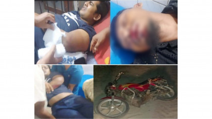 জাটকা বিরোধী অভিযানে যাওয়ার পথে হামলা, তিন কর্মচারী রক্তাক্ত জখম