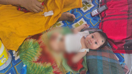 পিরোজপুরে হাত-পা বিহীন নবজাতক: বাবার অস্বীকৃতি, মায়ের অটুট ভালোবাসা