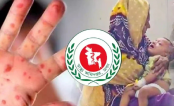 হাম ও উপসর্গ নিয়ে আরও ৫ শিশুর মৃত্যু