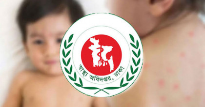 দেশে হাম ও হামের উপসর্গে মৃত্যু ৮০০ ছাড়ালো  
