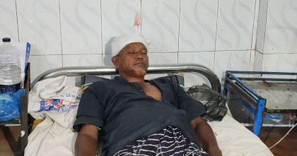 মদনপুরের চর বৈরাগী ফের আনোয়ার বাহিনীর হাতে কৃষক আহত 