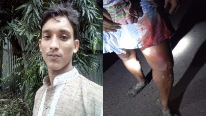 বাঁশখালীতে মাছের ঘের দখল নিয়ে দুই পক্ষের সংঘর্ষ-গোলাগুলি: নিহত ১, গুলিবিদ্ধ অন্তত ৮