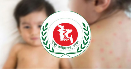 হামের উপসর্গে ২৪ ঘণ্টায় আরও পাঁচ শিশুর মৃত্যু