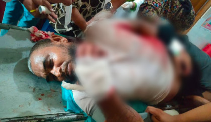 লংমার্চ শেষে সিরাজগঞ্জে জামায়াত নেতাকে কুপিয়ে জখমের অভিযোগ