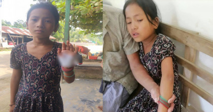 সাজেকে শিশু গুলিবিদ্ধের ঘটনায় পিসিসিপির তীব্র নিন্দা