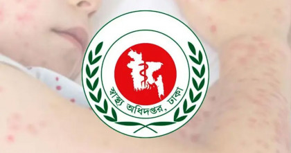 দেশে হাম উপসর্গে আরও পাঁচ জনের মৃত্যু; আক্রান্ত এক হাজার ৩৫৬   